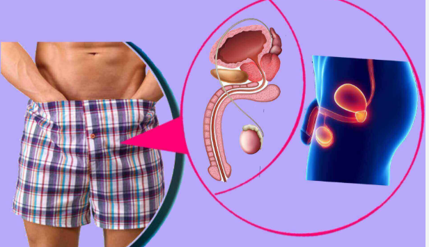 Erectile Dysfunction