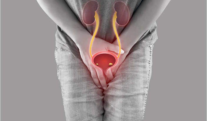 Urinary Incontinence